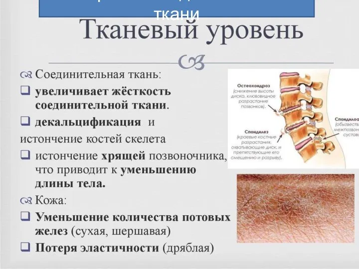 Старение соединительной ткани