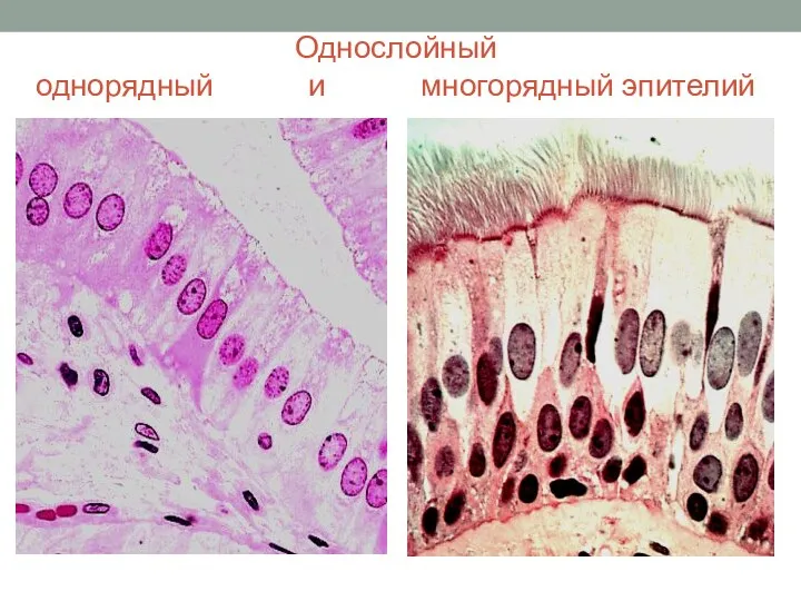 Однослойный однорядный и многорядный эпителий