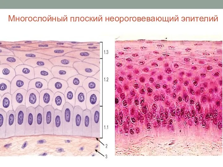 Многослойный плоский неороговевающий эпителий