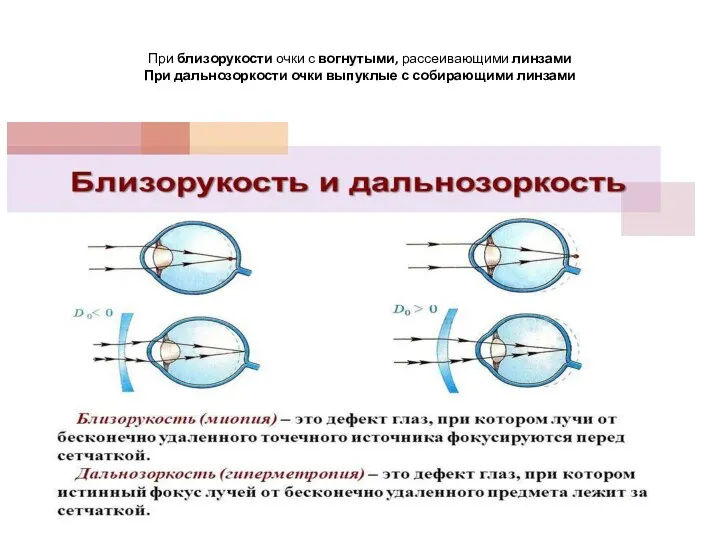 При близорукости очки с вогнутыми, рассеивающими линзами При дальнозоркости очки выпуклые с собирающими линзами