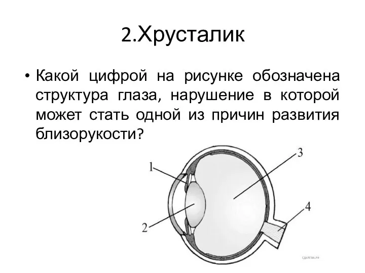 2.Хрусталик Какой цифрой на рисунке обозначена структура глаза, нарушение в которой