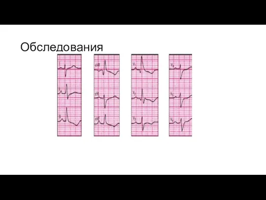 Обследования