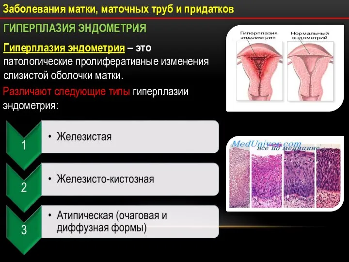 Гиперплазия эндометрия – это патологические пролиферативные изменения слизистой оболочки матки. Заболевания