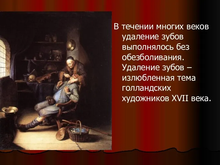 В течении многих веков удаление зубов выполнялось без обезболивания. Удаление зубов