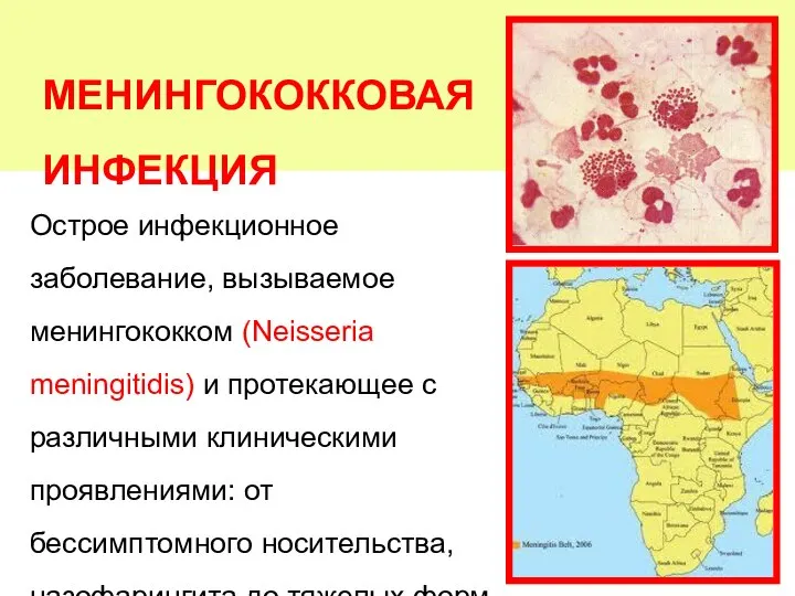 МЕНИНГОКОККОВАЯ ИНФЕКЦИЯ Острое инфекционное заболевание, вызываемое менингококком (Neisseria meningitidis) и протекающее