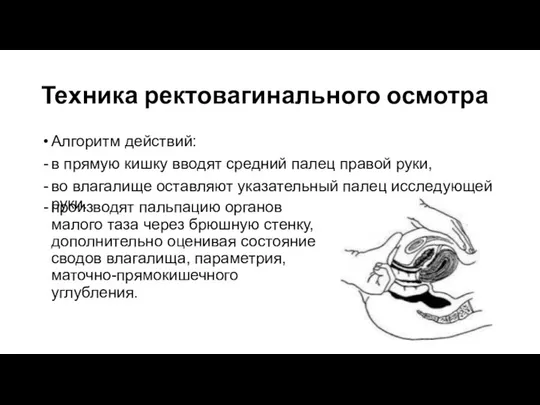 Техника ректовагинального осмотра Алгоритм действий: в прямую кишку вводят средний палец