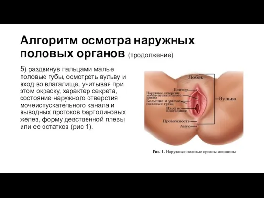 Алгоритм осмотра наружных половых органов (продолжение) 5) раздвинув пальцами малые половые