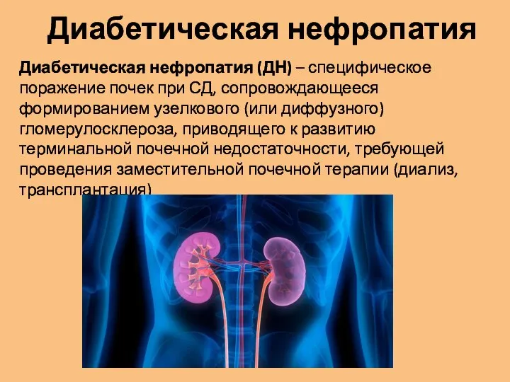 Диабетическая нефропатия (ДН) – специфическое поражение почек при СД, сопровождающееся формированием