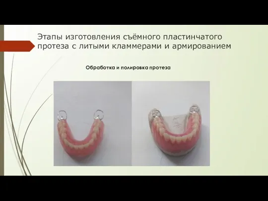 Этапы изготовления съёмного пластинчатого протеза с литыми кламмерами и армированием Обработка и полировка протеза