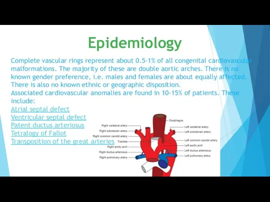 Complete vascular rings represent about 0.5-1% of all congenital cardiovascular malformations.