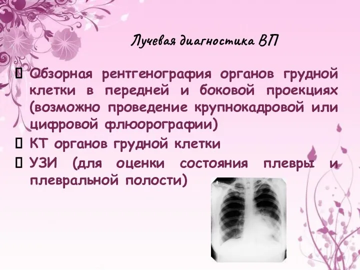 Лучевая диагностика ВП Обзорная рентгенография органов грудной клетки в передней и
