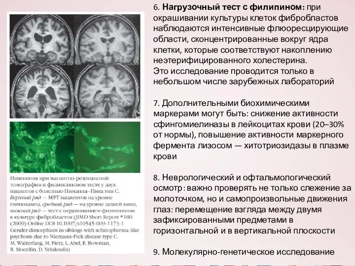 6. Нагрузочный тест с филипином: при окрашивании культуры клеток фибробластов наблюдаются