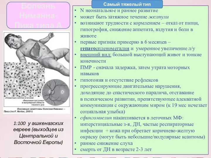 Болезнь Ниманна-Пика типа А N неонатальное и раннее развитие может быть