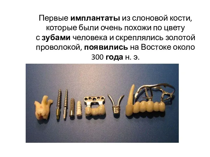 Первые имплантаты из слоновой кости, которые были очень похожи по цвету