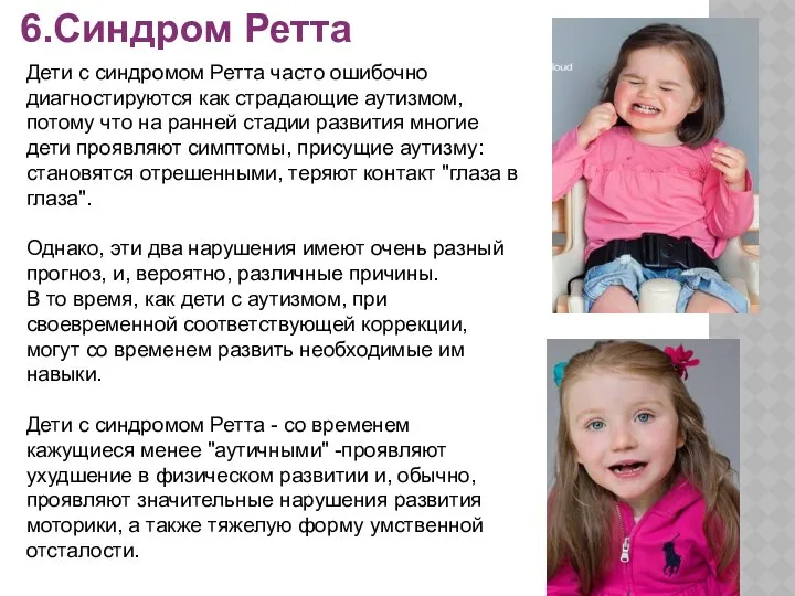 6.Синдром Ретта Дети с синдромом Ретта часто ошибочно диагностируются как страдающие