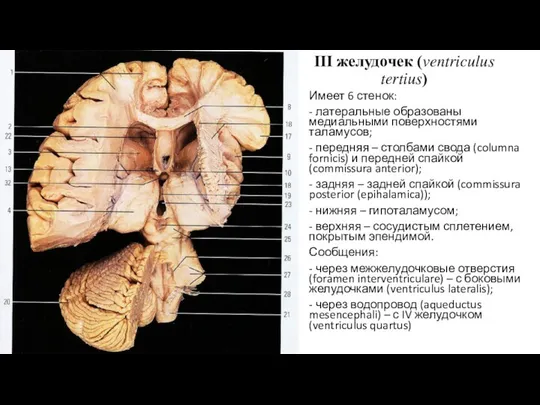 III желудочек (ventriculus tertius) Имеет 6 стенок: - латеральные образованы медиальными