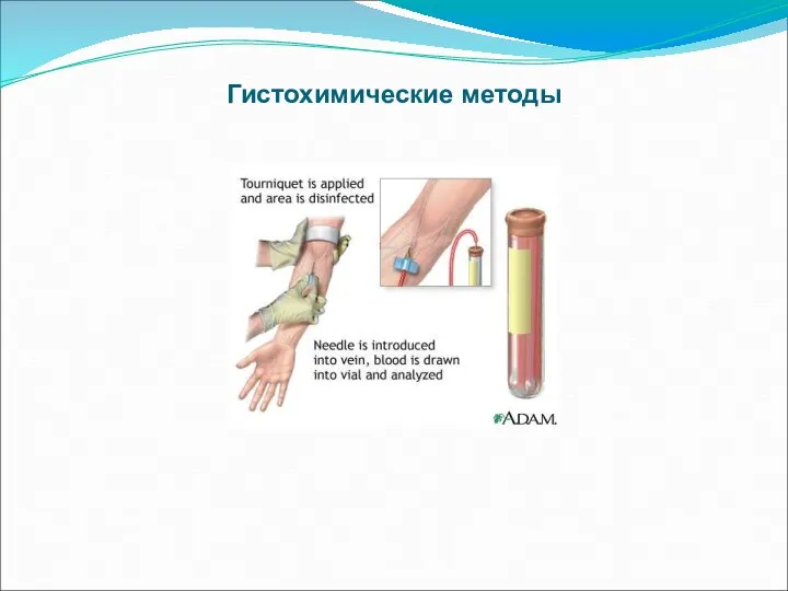 Гистохимические методы