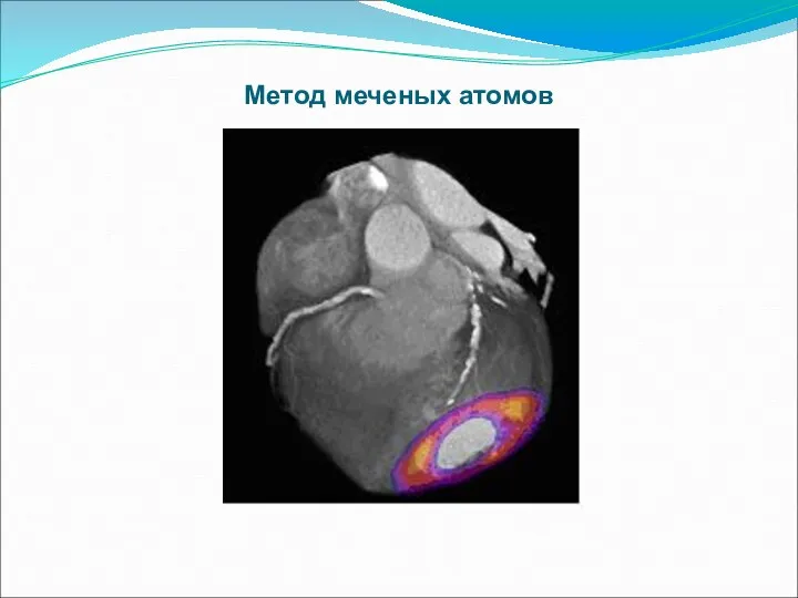 Метод меченых атомов