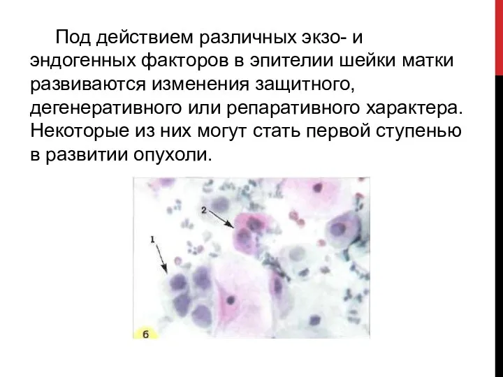 Под действием различных экзо- и эндогенных факторов в эпителии шейки матки