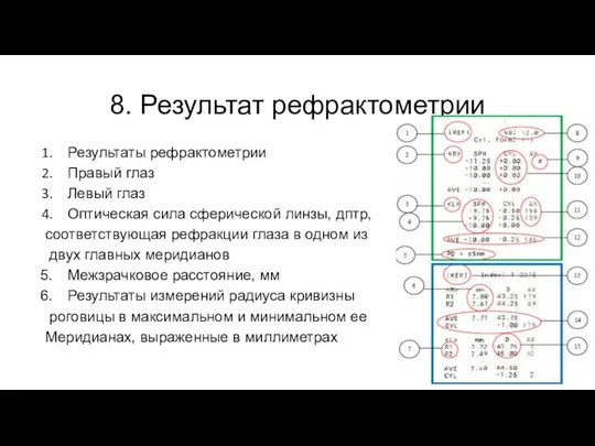 8. Результат рефрактометрии Результаты рефрактометрии Правый глаз Левый глаз Оптическая сила