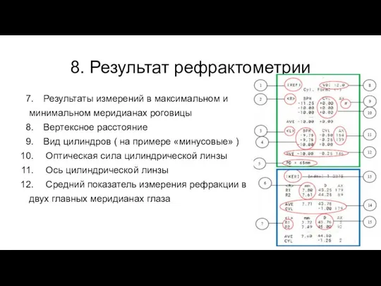 8. Результат рефрактометрии Результаты измерений в максимальном и минимальном меридианах роговицы