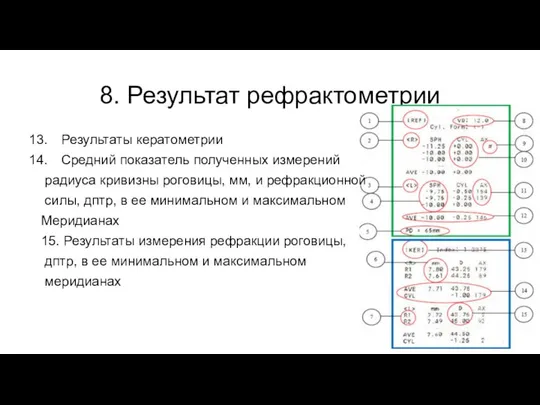 8. Результат рефрактометрии Результаты кератометрии Средний показатель полученных измерений радиуса кривизны