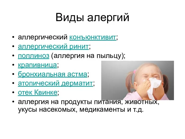 Виды алергий аллергический конъюнктивит; аллергический ринит; поллиноз (аллергия на пыльцу); крапивница;