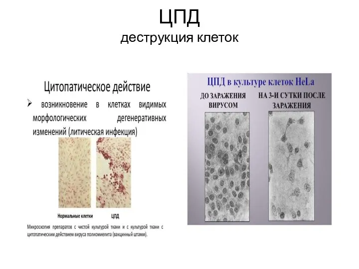 ЦПД деструкция клеток