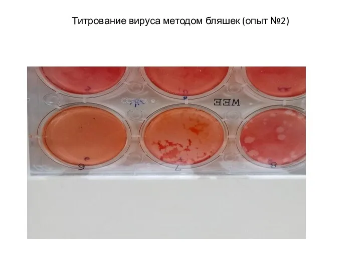 Титрование вируса методом бляшек (опыт №2)