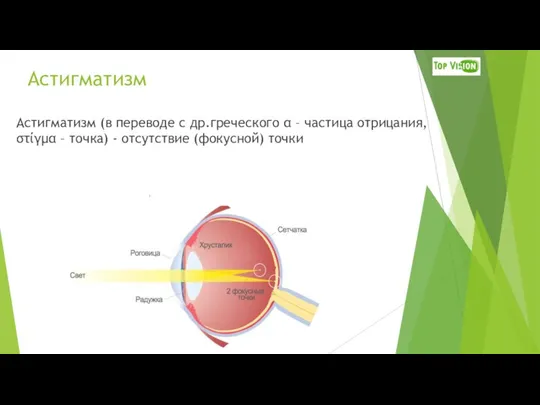 Астигматизм Астигматизм (в переводе с др.греческого α – частица отрицания, στίγμα