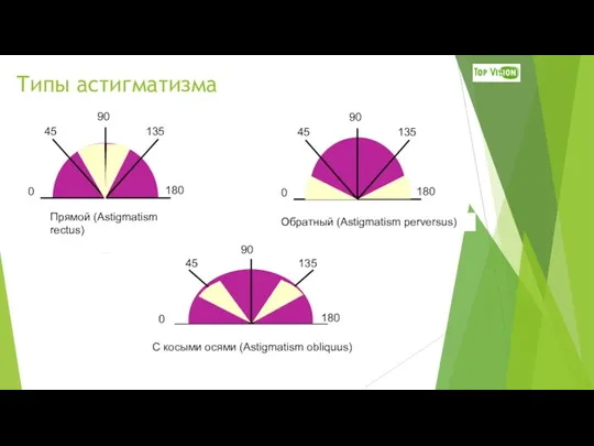 Типы астигматизма