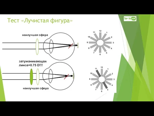 наилучшая сфера затуманивающая линза+0.75 D!!! Тест «Лучистая фигура» наилучшая сфера