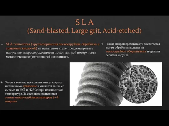 S L A (Sand-blasted, Large grit, Acid-etched) SLA технология (крупнозернистая пескоструйная