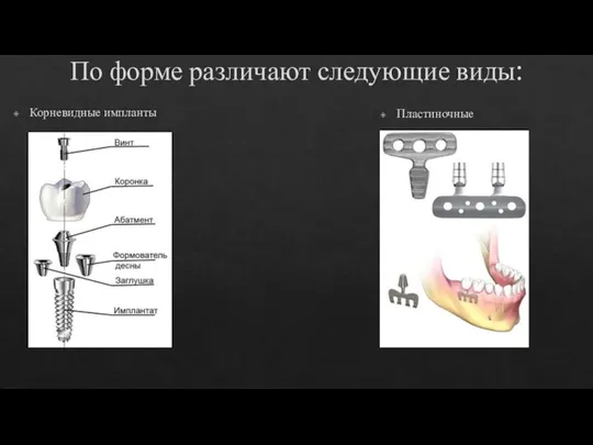 По форме различают следующие виды: Корневидные импланты Пластиночные