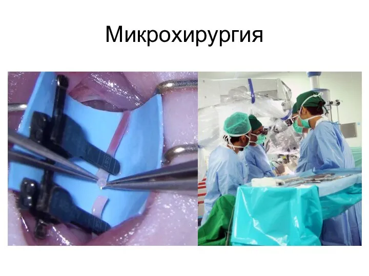 Микрохирургия