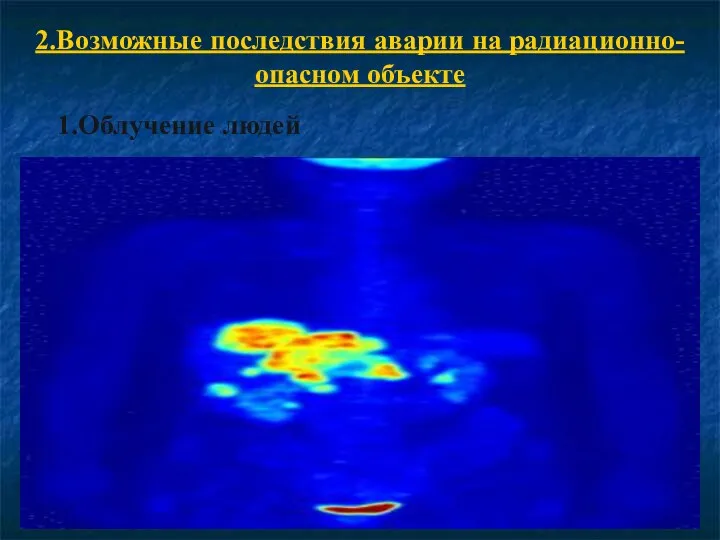 2.Возможные последствия аварии на радиационно-опасном объекте 1.Облучение людей