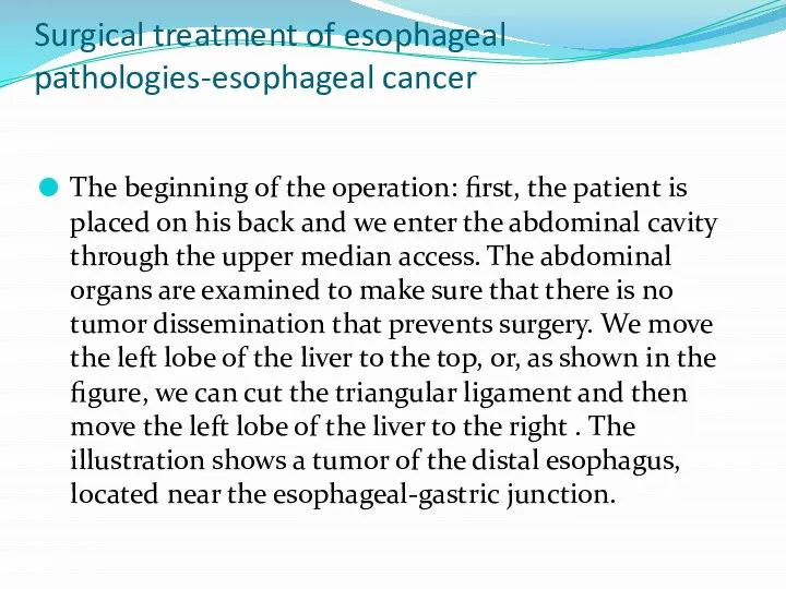 Surgical treatment of esophageal pathologies-esophageal cancer The beginning of the operation:
