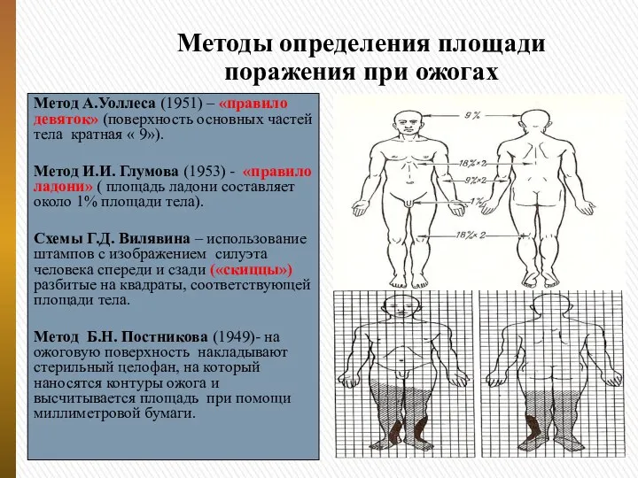 Методы определения площади поражения при ожогах Метод А.Уоллеса (1951) – «правило