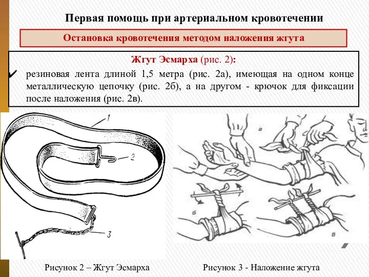 Первая помощь при артериальном кровотечении Остановка кровотечения методом наложения жгута Жгут