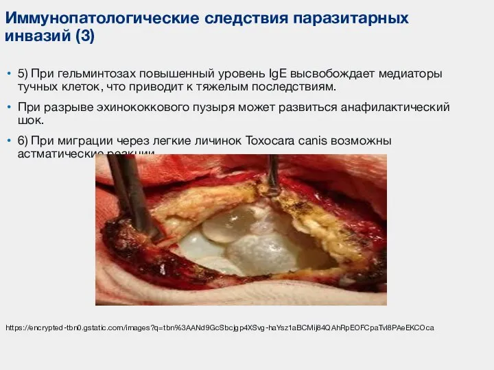 5) При гельминтозах повышенный уровень IgE высвобождает медиаторы тучных клеток, что