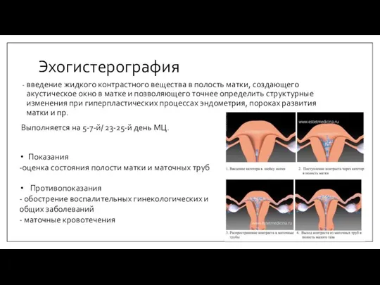 Эхогистерография введение жидкого контрастного вещества в полость матки, создающего акустическое окно