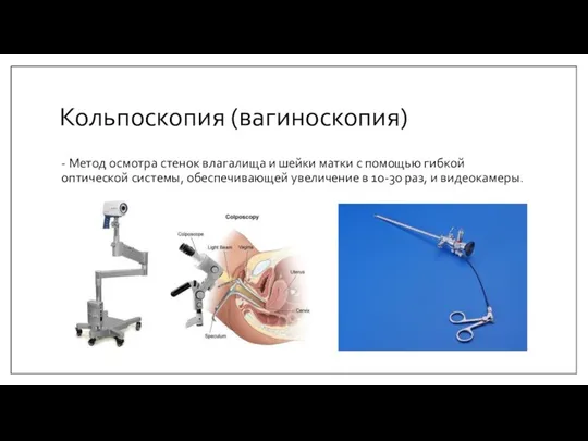 Кольпоскопия (вагиноскопия) - Метод осмотра стенок влагалища и шейки матки с