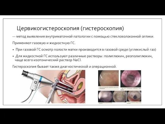 Цервикогистероскопия (гистероскопия) — метод выявления внутриматочной патологии с помощью стекловолоконной оптики.