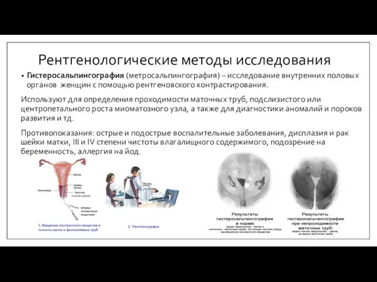 Рентгенологические методы исследования Гистеросальпингография (метросальпингография) – исследование внутренних половых органов женщин