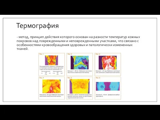 Термография - метод, принцип действия которого основан на разности температур кожных