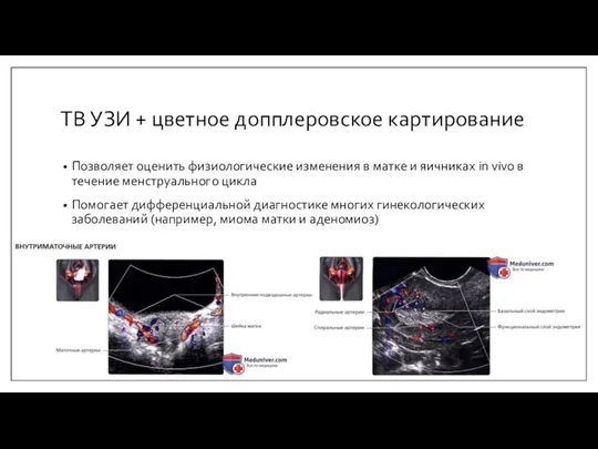 ТВ УЗИ + цветное допплеровское картирование Позволяет оценить физиологические изменения в