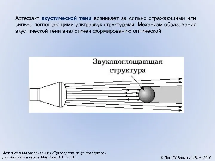 Артефакт акустической тени возникает за сильно отражающими или сильно поглощающими ультразвук