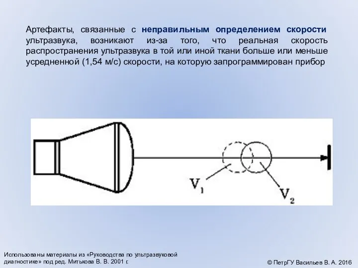 Артефакты, связанные с неправильным определением скорости ультразвука, возникают из-за того, что