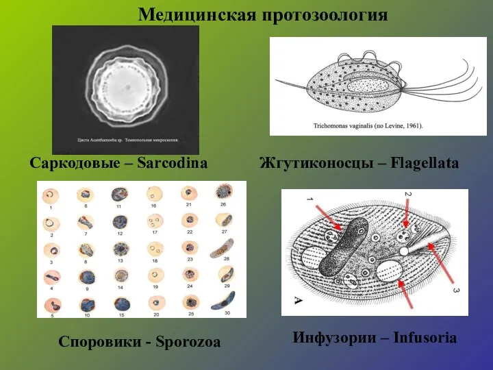 Медицинская протозоология Саркодовые – Sarcodina Жгутиконосцы – Flagellatа Споровики - Sporozoa Инфузории – Infusoria