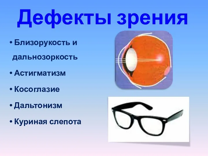 Дефекты зрения Близорукость и дальнозоркость Астигматизм Косоглазие Дальтонизм Куриная слепота